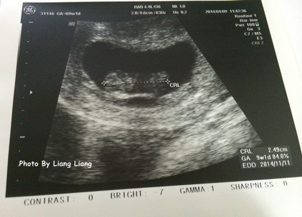 二寶(9W1D)♥第一次產檢‧第二胎肚子真的爆大